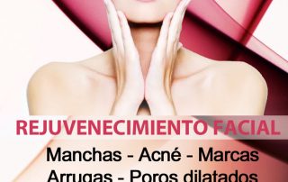 FLYER-PEELING-DELANTE